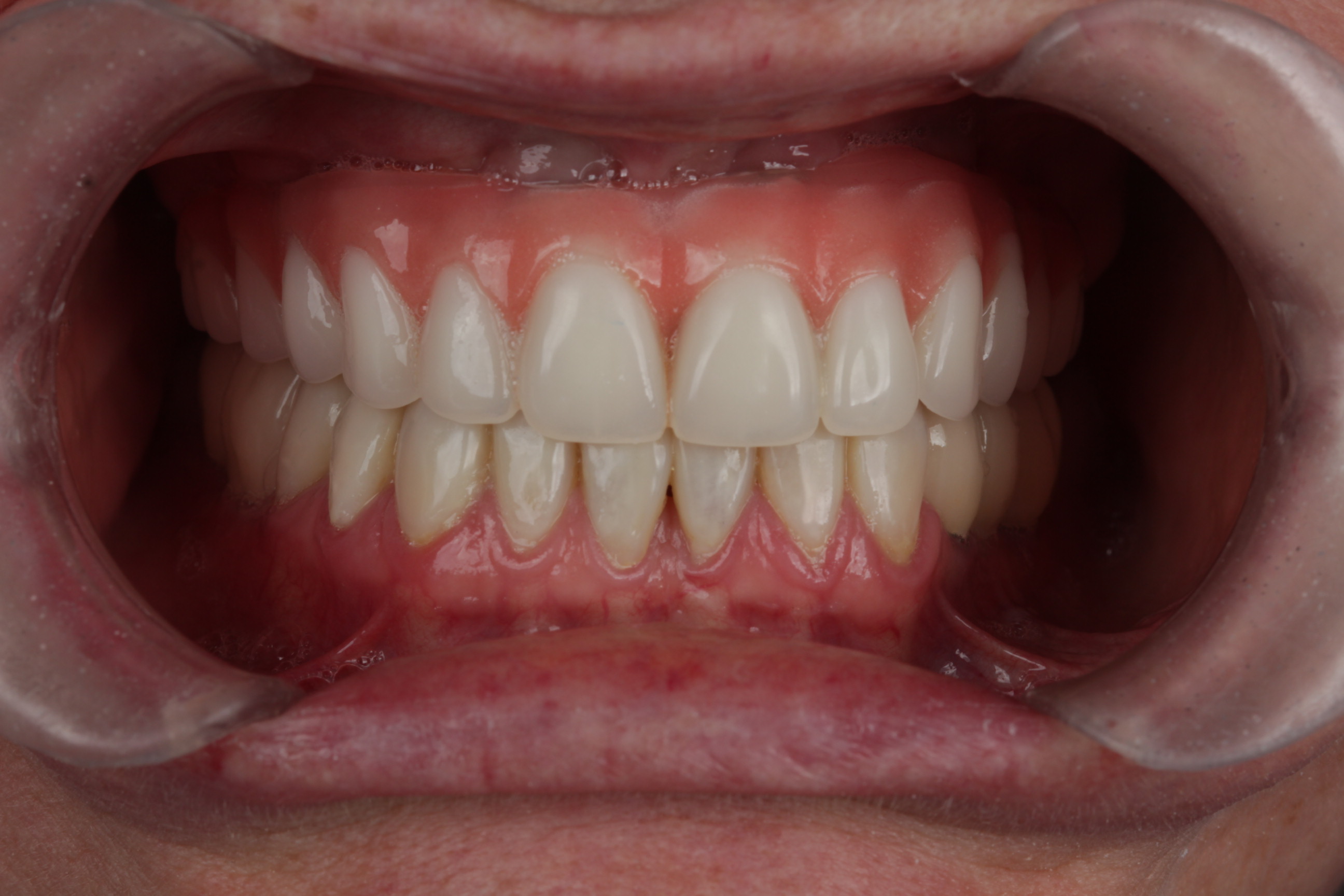 Sorriso visto de perto para ilustrar a avaliação odontológica