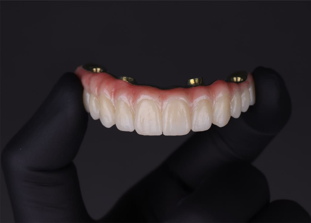 Prótese protocolo dentária